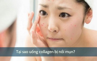 Tại sao uống collagen bị nổi mụn và cách khắc phục?