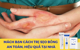 Mách bạn cách trị sẹo bỏng hiệu quả tại nhà