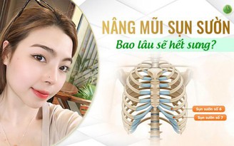 Nâng mũi cấu trúc Sụn sườn Fascia bao lâu hết sưng ?