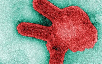 Bạn biết gì về virus Marburg đáng sợ như Ebola vừa tái xuất ở châu Phi?