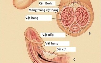 Cấp cứu bệnh nhân bị cương 'cậu nhỏ' kéo dài sau đột quỵ não