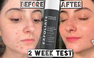 Review tẩy tế bào chết 2% BHA Paula's Choice Skin Perfecting Liquid Exfoliant Review tẩy tế bào chết 2% BHA Paula's Choice Skin Perfecting Liquid Exfoliant