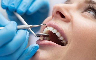 Sâu răng được trám có bị sâu lại không?