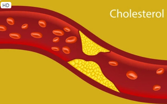 Chuyên gia chỉ cách để giảm cholesterol nhanh, hiệu quả