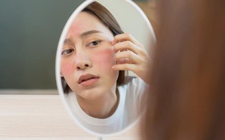 Chuyên gia chỉ cách phục hồi da sau treatment quá đà