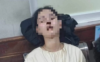 Đồng Nai: Cô gái 18 tuổi bị mù mắt trái sau khi tiêm filler
