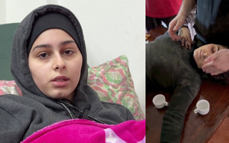 Giữa bom đạn, bác sĩ Gaza phẫu thuật đoạn chi cho cháu gái mà không gây mê