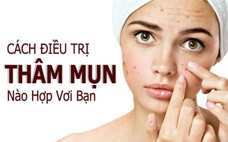 Top 9 kem trị thâm mụn lâu năm cho làn da tươi sáng đều màu