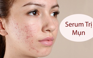 Top 10 serum trị mụn ẩn, mụn viêm, mụn trứng cá được tìm mua nhiều hiện nay