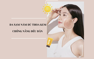 Da sạm nám dù thoa kem chống nắng đều đặn