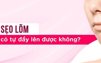 Sẹo lõm có tự đầy không? Cách trị sẹo lõm lấy lại làn da mịn màng