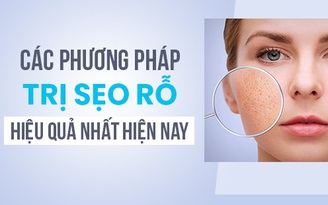 Top 7 phương pháp trị sẹo rỗ hiệu quả đang được áp dụng phổ biến