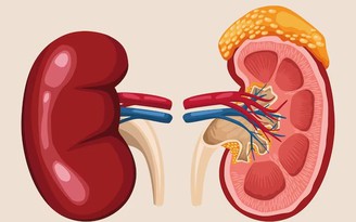 9 thói quen không ngờ lại gây suy thận