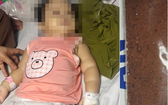 Bé gái 11 tuổi ngộ độc nguy kịch do dùng ‘thuốc cam’ gia truyền