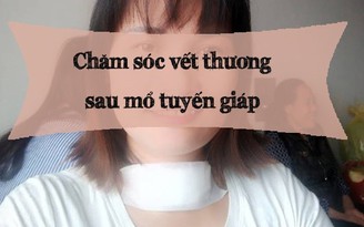 Chăm sóc vết mổ tuyến giáp như thế nào mau lành và ngăn ngừa sẹo xấu?