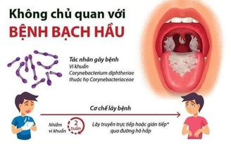 Bệnh bạch hầu: Bác sĩ nêu triệu chứng phân biệt viêm họng thông thường