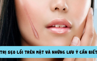 Bật mí cách trị sẹo lồi trên mặt hiệu quả tại nhà mà không cần xâm lấn