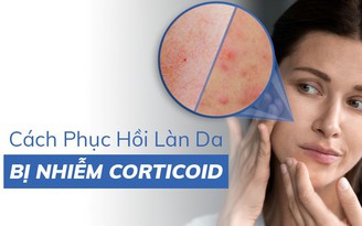 Làm thế nào để phục hồi làn da nhiễm corticoid khỏe đẹp trở lại?