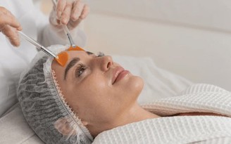 Da đỏ rát sau peel/tretinol - cơ chế phục hồi khoa học