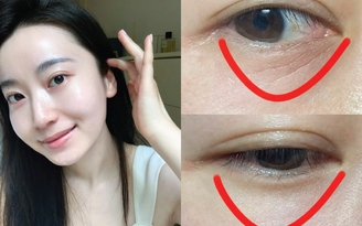 Top 6 Retinol cứ thoa là da căng trẻ, bất chấp tuổi nào cũng ngược về 20+