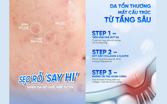 Đừng để sẹo mụn kéo lùi bạn, chăm da đẹp, tự tin trở lại, cơ hội đến