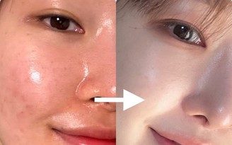 Top 6 kem Retinol hot 2025 giúp da căng mướt, trẻ đẹp không cần filter!