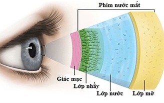 Khô mắt: Mối lo phổ biến trong thời đại số và các giải pháp chăm sóc mắt