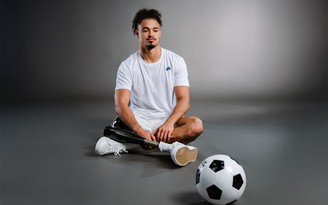 Cầu thủ Pháp cắt bỏ chân vì mắc não mô cầu: Bệnh rình rập người trẻ khỏe