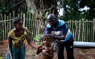 WHO: Bệnh 'bí ẩn' xuất hiện ở Congo, gây chết người nhanh