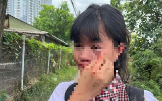 Nhóm hành hung nữ sinh ở TP.Thủ Đức, khai gì?