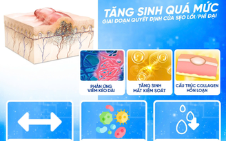 Bí quyết chọn kem trị sẹo sau phẫu thuật: Làm sao để đạt hiệu quả tối ưu?
