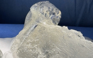 Tháo túi ngực không đau