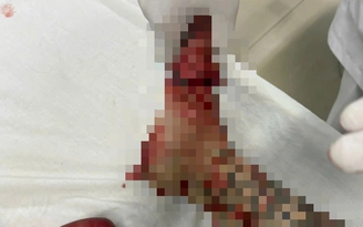 Hỗn chiến trong đêm, 2 người bị thương sau tiếng nổ lớn