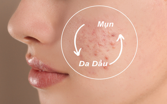 Top 7 sữa rửa mặt cho da dầu mụn sạch mịn, dịu nhẹ đang được mua nhiều