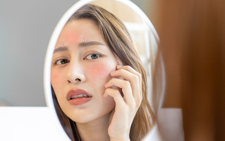 Top 7 sản phẩm làm dịu da đỏ, kích ứng sau laser hiệu quả