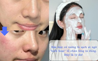 Rửa mặt cứ tưởng là sạch ai ngờ ‘kích hoạt’ lỗ chân lông to đùng!