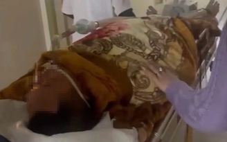 Người đàn ông nguy kịch sau khi ăn tiết canh dê