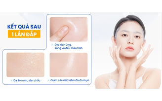 Thương hiệu Việt lên ngôi: Top 3 mặt nạ da căng mướt, bừng sáng sau 1 đêm