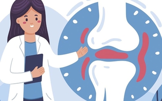 Giải mã chìa khóa bảo vệ sức khỏe cơ xương khớp Giải mã chìa khóa bảo vệ sức khỏe cơ xương khớp