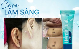 Gel bôi vết thương hở HemaHeal có hỗ trợ mau lành như quảng cáo không?