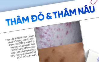 Top cách chăm sóc da thâm đỏ sau mụn bạn nên thử ngay trong routine hằng ngày