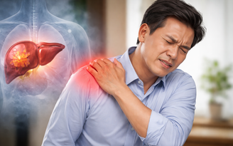 Đau vai không rõ nguyên nhân có phải là dấu hiệu của ung thư gan?