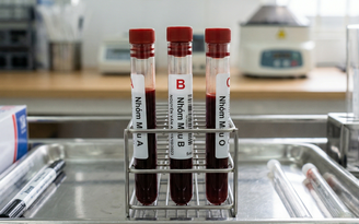 Người nhóm máu nào cần cảnh giác với bệnh tiểu đường hơn?