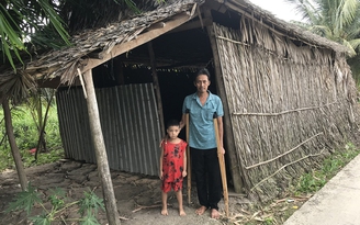 Bị hoại tử chỏm xương đùi, người đàn ông nghèo mong được giúp đỡ