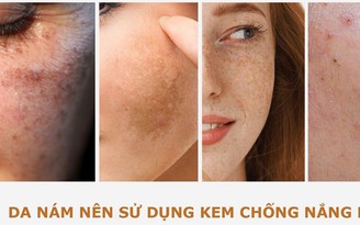 Nám tái đi tái lại do chưa ‘update’ 3 kem chống nắng cho da nám dưới đây!