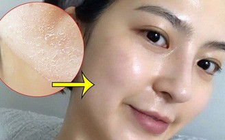 Top 6 sữa rửa mặt cho da khô ráp, nứt nẻ cũng trở nên mềm mịn