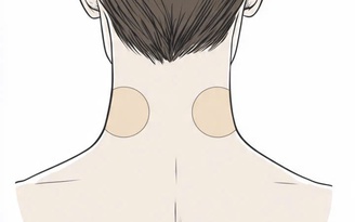 Bé gái 7 tuổi loạn thần cấp tính sau khi dùng miếng dán chống say tàu xe