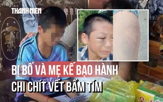Toàn cảnh vụ bé trai nghi bị bố và mẹ kế bạo hành: Đã nhập viện với chi chít vết bầm tím