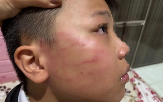 Thầy giáo người Ấn Độ tát học sinh lớp 4: Kiểm tra việc dạy thêm không phép