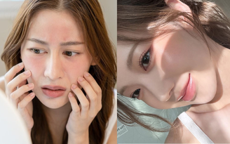 Collagen không phải cứ uống là đẹp mà bí quyết từ chuyên gia chia sẻ dưới đây!